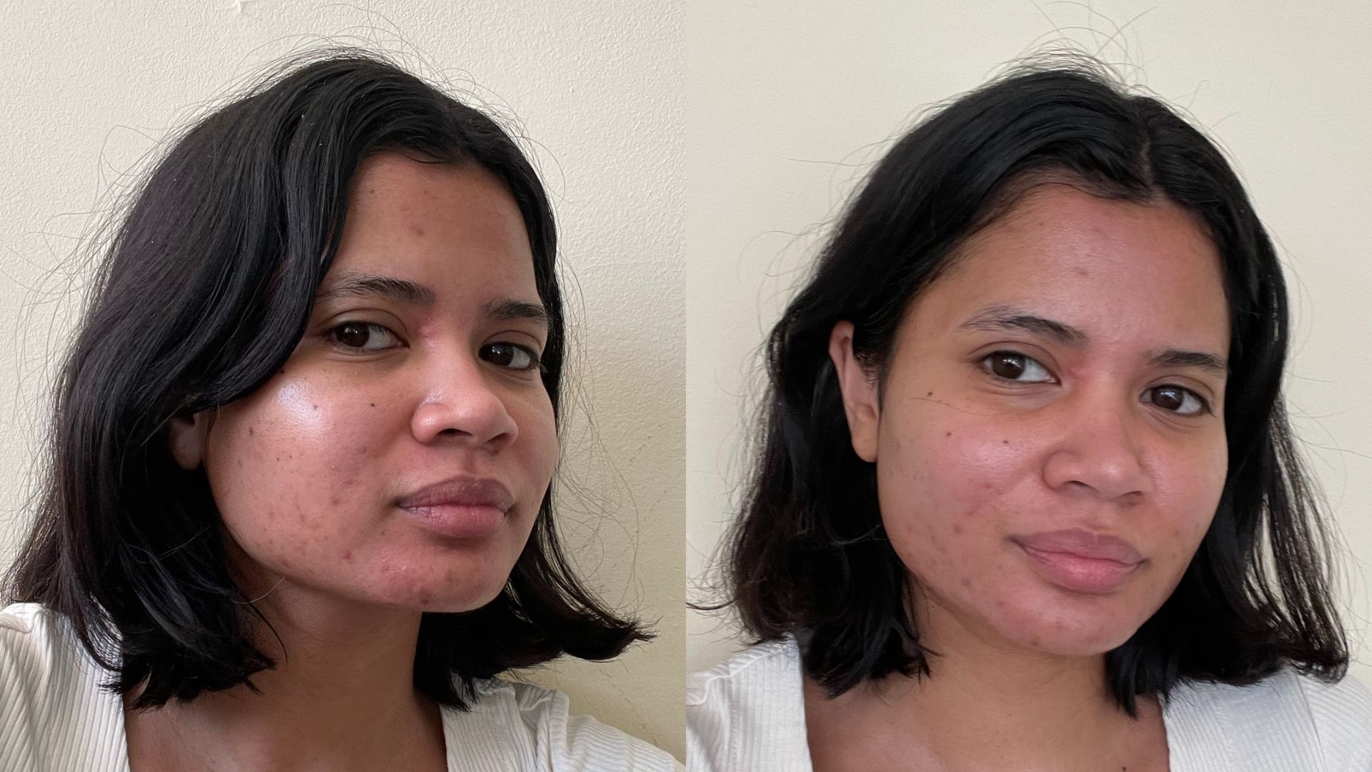 Elemis Pro Marine Collagen Cream Hanitra Before And After Elemis Pro Marine Collagen Cream Hanitra Before And After